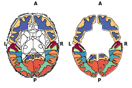 Hide regions plot
